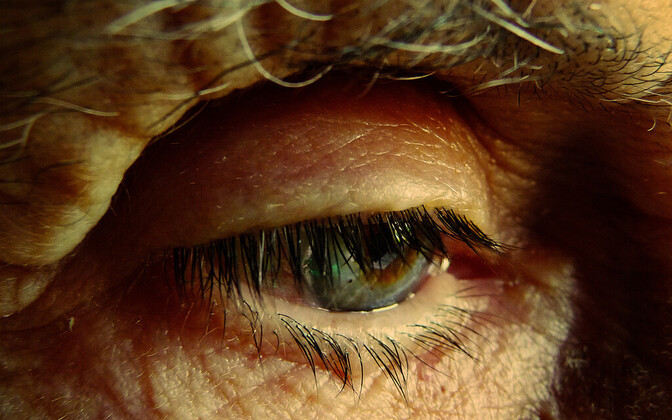 Uus ravimikandidaat aeglustas Alzheimeri tõve kulgu kolmandiku võrra