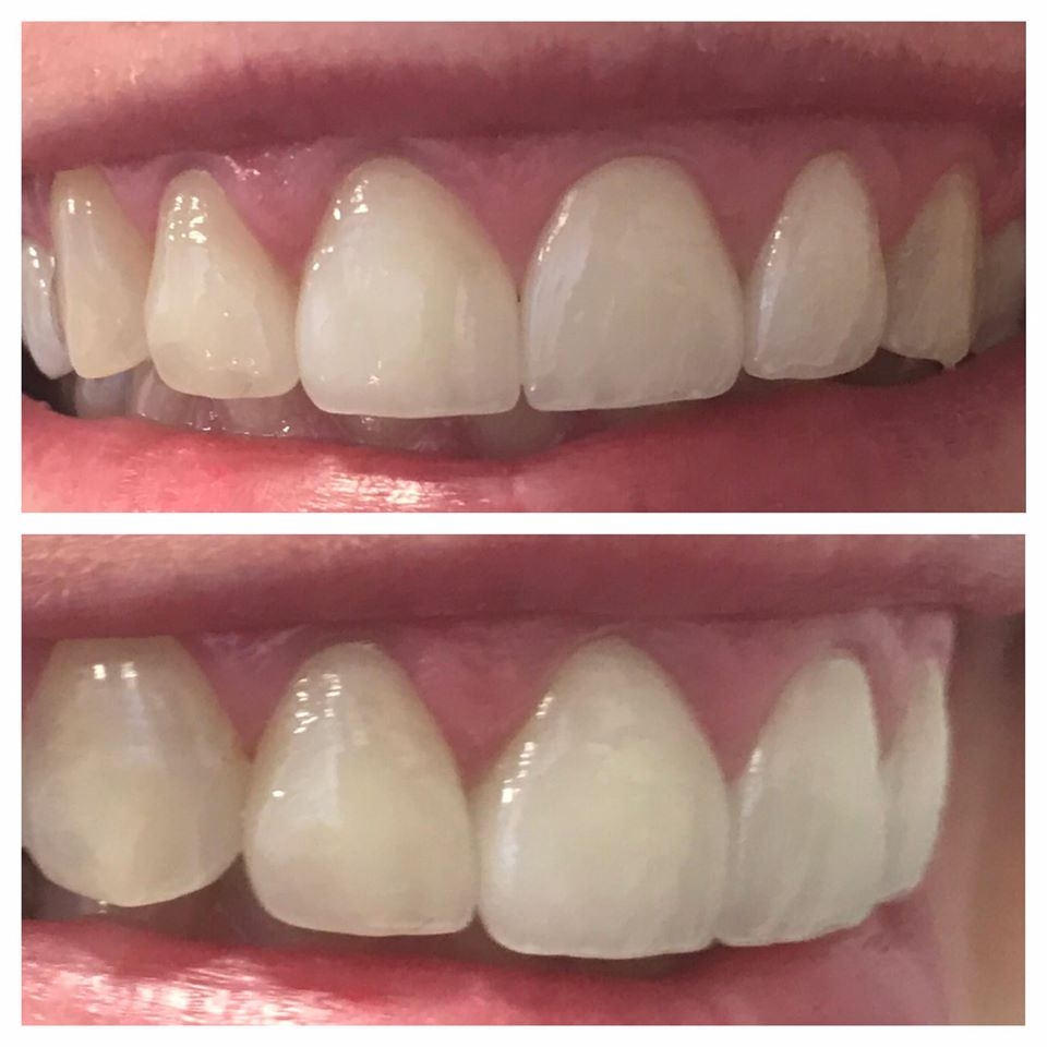 Disainer jagab nippe: kuidas hooldada pidurõivaid nii, et need kestaksid aastaid