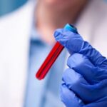 LÄBIMURRE ⟩ Uus vereproov suudab avastada vähi enne sümptomite teket