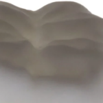 Revolutsioon hambaravis – zirkooniumkroonid saab suhu samal päeval