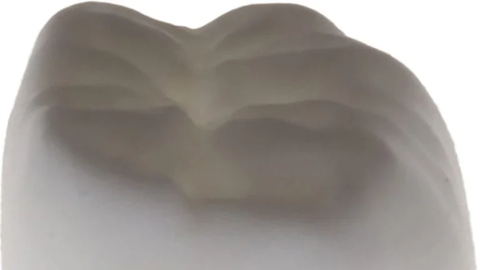 Revolutsioon hambaravis – zirkooniumkroonid saab suhu samal päeval