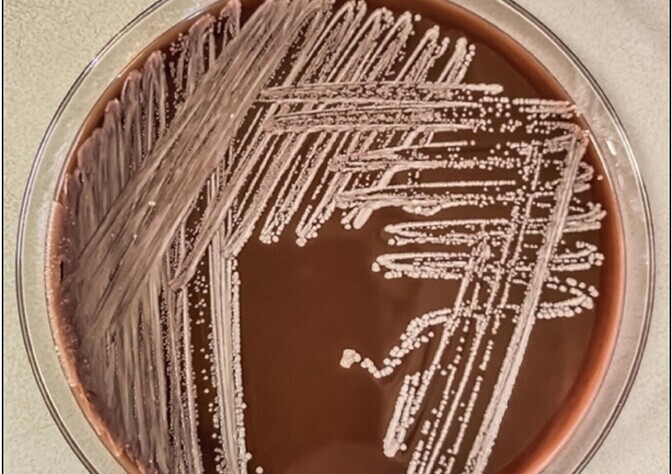 Mullabakteri ravimikokteil võib leevendada antibiootikumiresistentsust